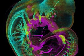 Embrión de ratón en desarrollo (James Sharpe / CRG / EMBL)